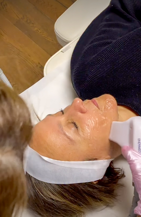 Ραδιοσυχνότητα προσώπου, IG @sadaf_jaffari | Treatwell