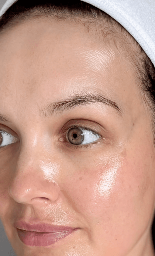 Peeling βιταμίνης C, IG @skincarebyjoanne | Treatwell