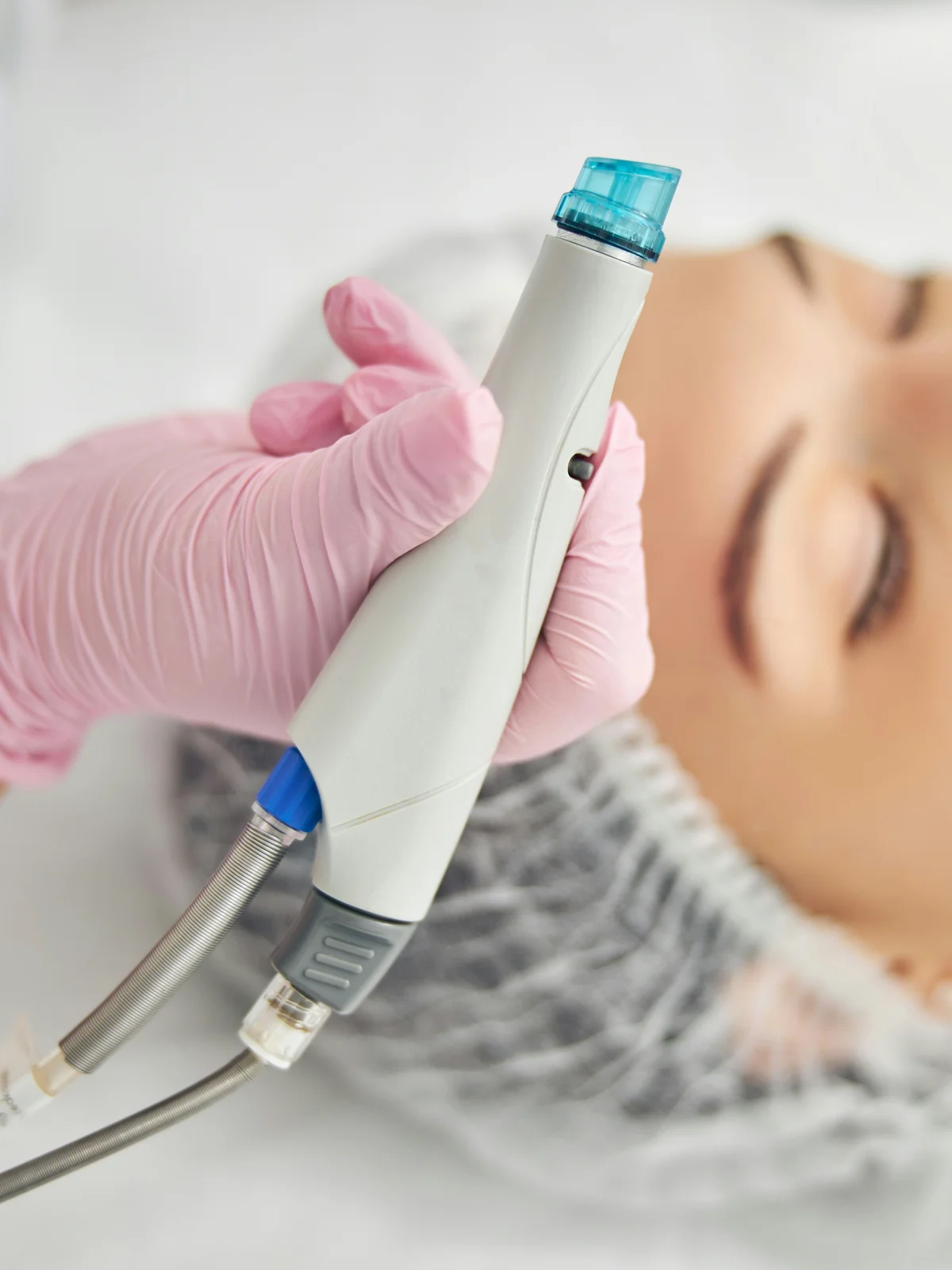 Κοντινό πλάνο μιας συσκευής HydraFacial με σπειροειδή κεφαλή που κρατά μια ειδικός
