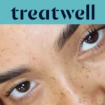 Τιρκουάζ banner της Treatwell με κοντινό πλάνο σε φυσικά ανασηκωμένες βλεφαρίδες μετά από korean lash lift, πάνω σε δέρμα με φακίδες