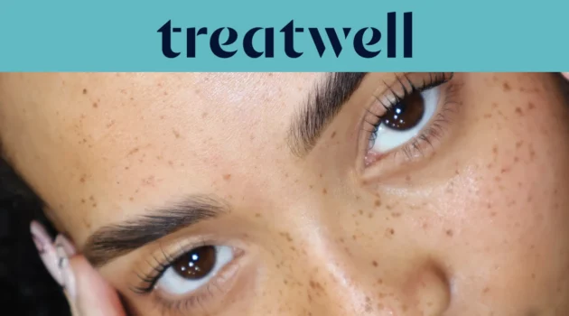 &Tau;&iota;&rho;&kappa;&omicron;&upsilon;ά&zeta; banner &tau;&eta;&sigmaf; Treatwell &mu;&epsilon; &kappa;&omicron;&nu;&tau;&iota;&nu;ό &pi;&lambda;ά&nu;&omicron; &sigma;&epsilon; &phi;&upsilon;&sigma;&iota;&kappa;ά &alpha;&nu;&alpha;&sigma;&eta;&kappa;&omega;&mu;έ&nu;&epsilon;&sigmaf; &beta;&lambda;&epsilon;&phi;&alpha;&rho;ί&delta;&epsilon;&sigmaf; &mu;&epsilon;&tau;ά &alpha;&pi;ό korean lash lift, &pi;ά&nu;&omega; &sigma;&epsilon; &delta;έ&rho;&mu;&alpha; &mu;&epsilon; &phi;&alpha;&kappa;ί&delta;&epsilon;&sigmaf;